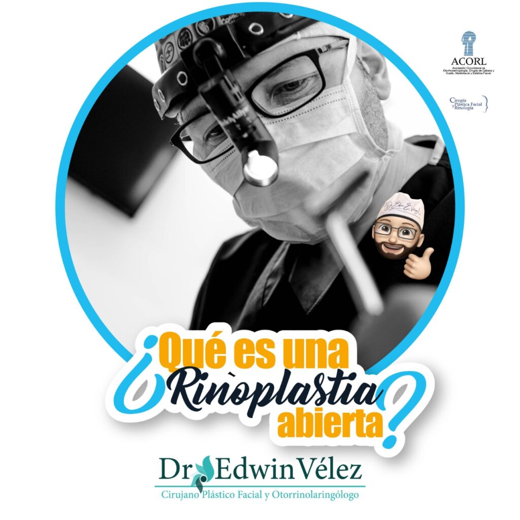 ¿qué Es Una Rinoplastia Abierta Doctor Edwin Vélez